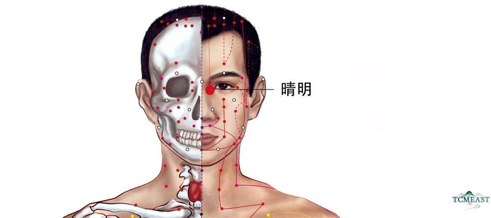 Jingming Point (BL-1 / Eye Brightness, also known as Leikong, Leikong, Leiqiang, Jingming, Muneizi)