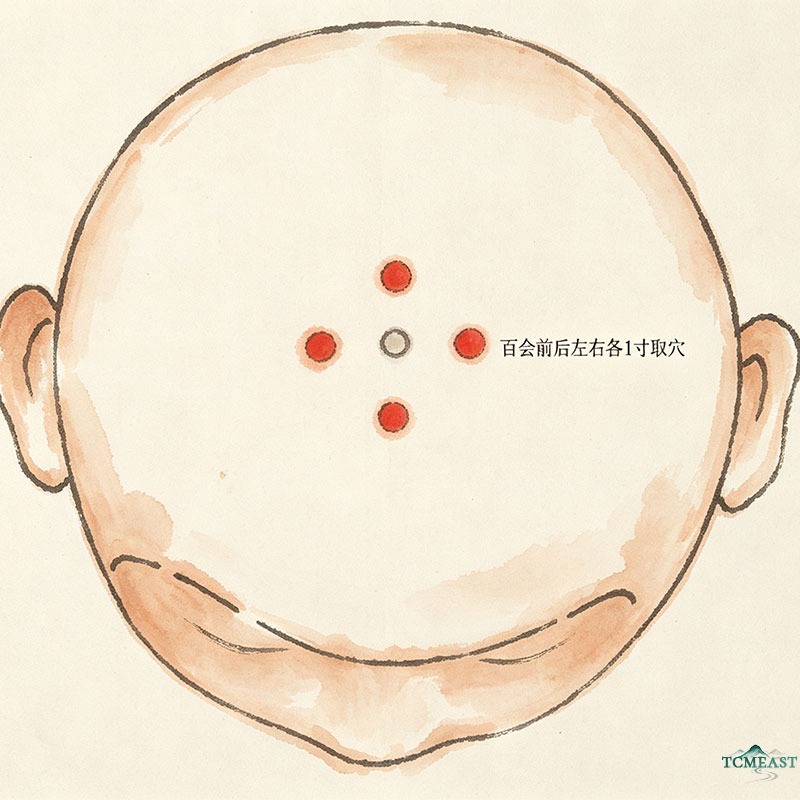 Sishencong Point (EX-HN1 / Four Spirits Acuity)