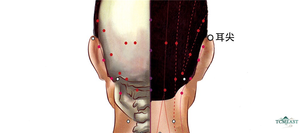 Erjian Point (EX-HN6 / Ear Tip)