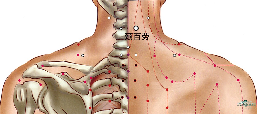 Jingbailao Point (EX-HN15 / Neck Hundred Strain)