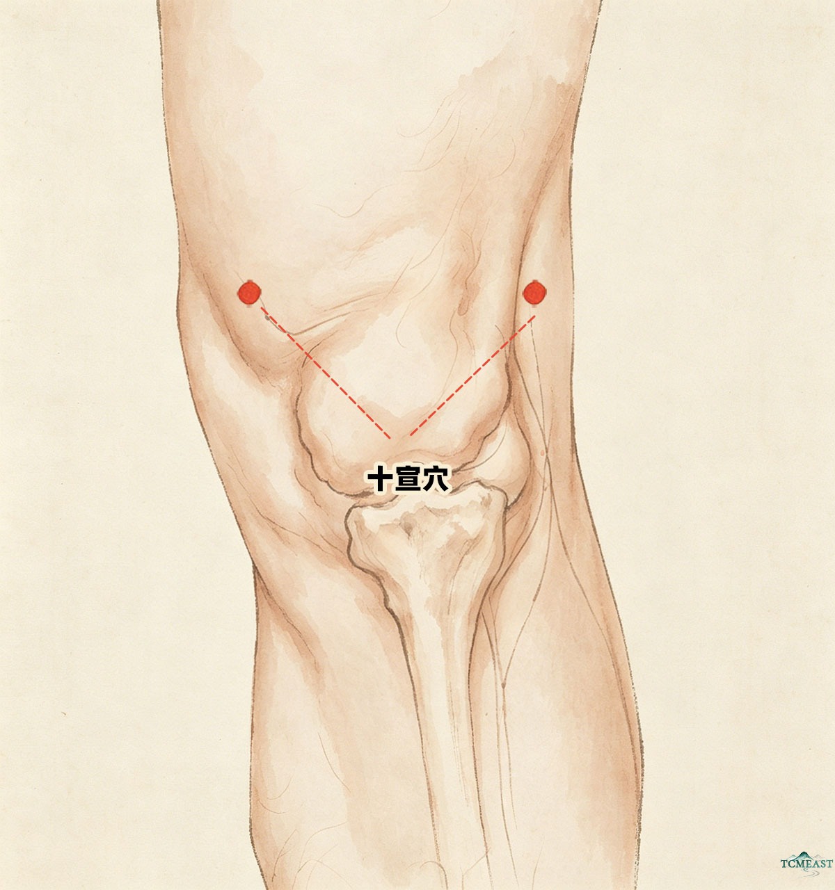 Kuangu Point (EX-LE1 / Hip Bone Point)