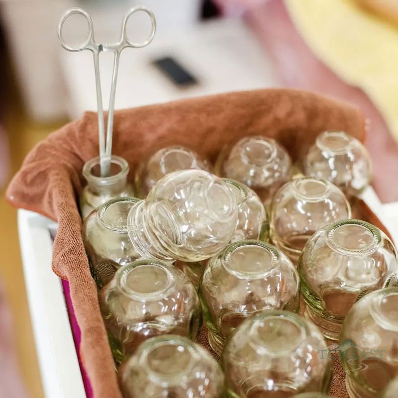 Cupping Therapy Explained: Benefits, Risks and What to Expect